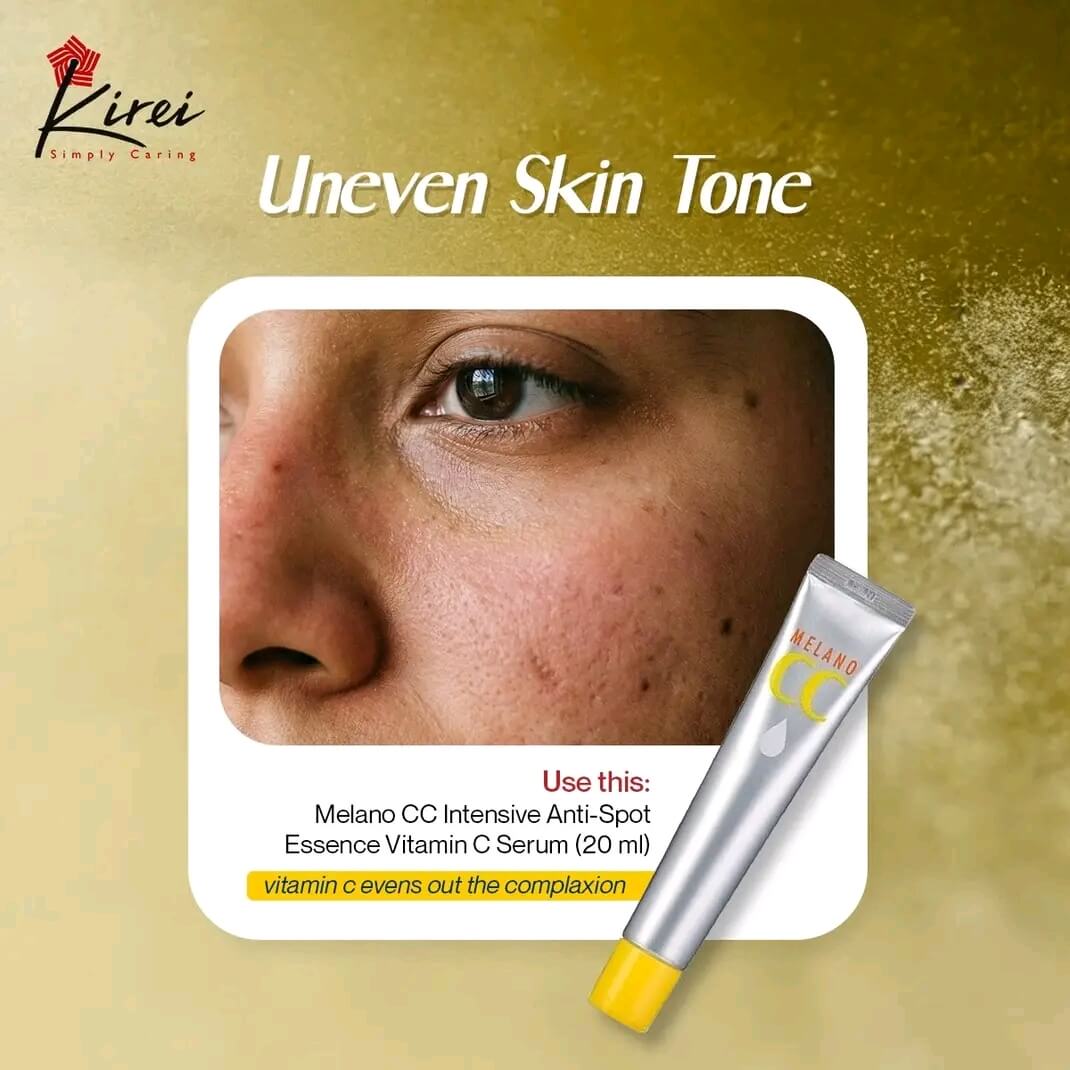 Melano CC Intensive Anti-Spot Essence Vitamin C Serum
