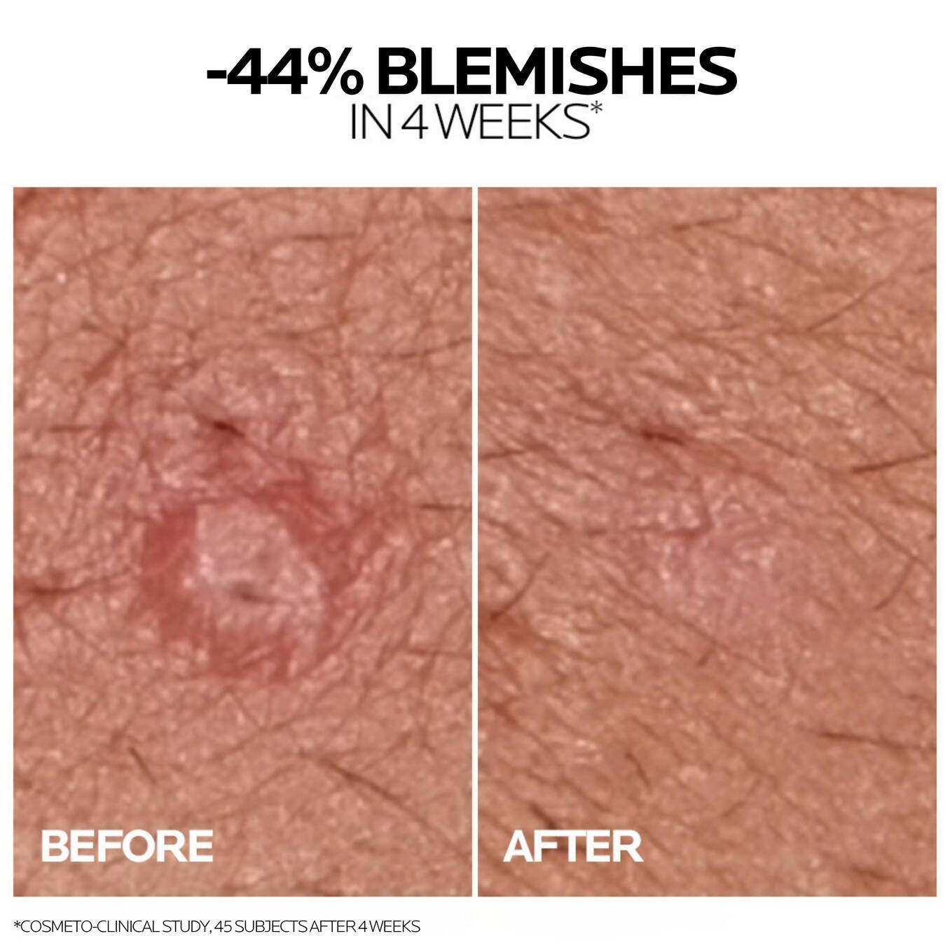 La Roche-Posay Effaclar Duo+
