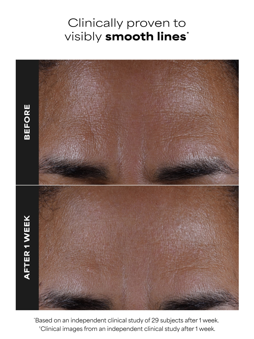 Paula's Choice 2% BHA Liquid Exfoliant
