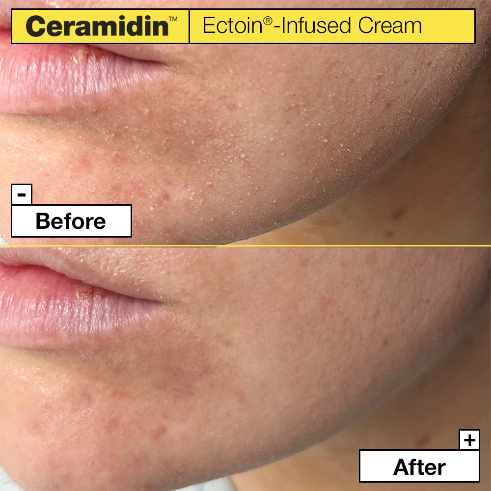 Dr. Jart Ceramidin Ectoin-Infused Cream